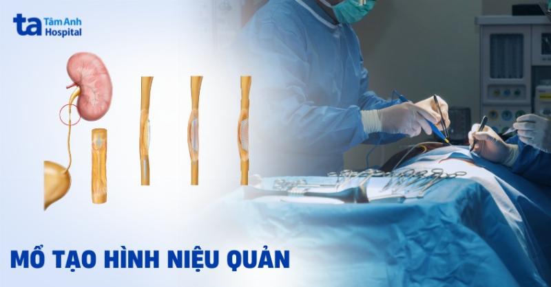Hinh anh dai dien cong ty gia anh chia se ve com niêu